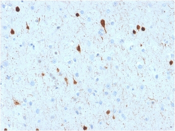 IHC testing of FFPE human cerebellum with CALB2 antibody (clone CALB2/2602). HIER: boil tissue sections in pH 9 10mM Tris with 1mM EDTA for 10-20 min followed by cooling at RT for 20 min.