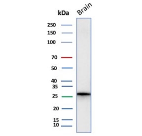Western blot testing of human brain lysate with CALB2 antibody (clone CALB2/2602). Expected molecular weight ~29 kDa.