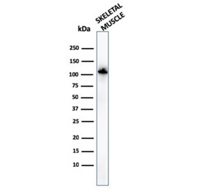 Western blot testing of human skeletal muscle lysate with Actinin Alpha 2 antibody. Predicted molecular weigth ~103 kDa.