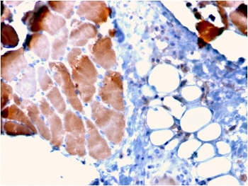 IHC staining of FFPE human skeletal muscle tissue with Actinin Alpha 2 antibody (clone ACTN2/3295). HIER: boil tissue sections in pH 9 10mM Tris with 1mM EDTA for 10-20 min and allow to cool before testing.