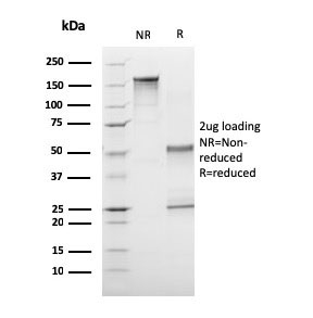 SDS-PAGE analysis of purified, BSA-free CD1A Antibody / Quantitative Specificity Validated Antibody (clone C1A/3249) as confirmation of integrity and purity.