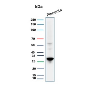 Western blot testing of human placental tissue lysate with PDLIM1 antibody. Predicted molecular weight ~36 kDa, observed here at ~28 kDa.