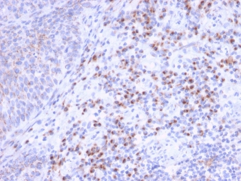 IHC staining of FFPE human tonsil tissue with EBAG9 antibody (clone CPTC-EBAG9-1). HIER: boil tissue sections in pH 9 10mM Tris with 1mM EDTA for 20 min and allow to cool before testing.