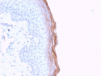 Kallikrein 5 Antibody Skin IHC. Immunohistochemistry analysis of FFPE human skin tissue stained with Kallikrein 5 Antibody demonstrates strong linear and cytoplasmic HRP-DAB brown staining within the superficial epidermal keratinocyte layers, consistent with KLK5-associated serine protease expression involved in epidermal barrier regulation and desquamation pathways. This epidermal barrier protease antibody highlights epithelial differentiation-associated signaling and cutaneous barrier homeostasis within stratified squamous epithelium. HIER: boil tissue sections in pH6, 10mM citrate buffer, for 20 min and allow to cool before testing.