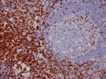 CD7 Antibody Lymph Node IHC. Immunohistochemistry analysis of CD7 / T-cell antigen CD7 in human lymph node tissue demonstrates strong HRP-DAB brown membranous staining of lymphocytes concentrated in paracortical regions with relative sparing of germinal centers, consistent with CD7 expression across T cell populations in immune profiling contexts, while surrounding stromal areas remain largely negative. Heat-induced epitope retrieval was performed in pH 9 Tris-EDTA buffer prior to antibody incubation, supporting its use as an immune profiling marker in FFPE tissue sections.