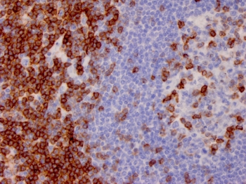 CD7 Antibody Human Lymph Node IHC. Immunohistochemistry analysis of CD7 / T-cell antigen CD7 in human lymph node tissue shows strong HRP-DAB brown membranous staining of densely packed lymphocytes within paracortical regions with relative sparing of germinal centers, consistent with CD7 expression across T cell populations used in immune profiling, while surrounding areas remain largely negative. Heat-induced epitope retrieval was performed in pH 9 Tris-EDTA buffer prior to antibody incubation, supporting its use as an immune profiling marker in FFPE tissue sections.