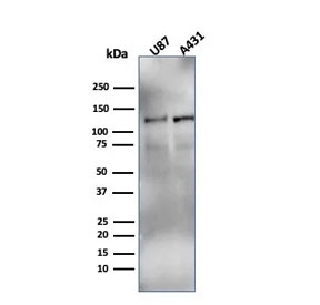 Western blot testing of human U-87 MG and A431 cell lysate with recombinant HIF1 alpha antibody (clone Ha111a).