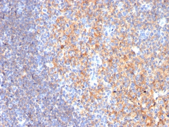Immunohistochemistry analysis of CD19 Antibody Mouse Monoclonal in human tonsil tissue. FFPE human tonsil demonstrates strong membranous HRP-DAB brown staining in B lymphocytes within germinal centers and follicular regions, consistent with CD19 (Cluster of Differentiation 19) expression on mature B cells, while interfollicular T cell-rich areas show reduced staining. Antigen retrieval was performed by boiling tissue sections in 10mM Tris with 1mM EDTA, pH 9.0, for 10-20 minutes followed by cooling prior to incubation with CD19 antibody (clone CD19/3116).