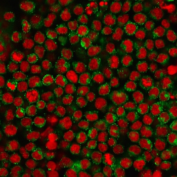 CD27 Antibody for IF. Immunofluorescence analysis of CD27 / TNFRSF7 expression in human Ramos B-cell lymphoma cells using CD27 Immunofluorescence Antibody clone LPFS2/1611. CD27 signal (green) shows distinct membranous localization outlining individual lymphocyte cells, while nuclei are counterstained with Reddot (red). The clear peripheral staining pattern is consistent with CD27 as a cell surface receptor and supports its use as a marker of activated and memory B cells in immunofluorescence-based immune profiling.