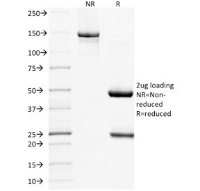SDS-PAGE analysis of purified, BSA-free Mucin 16 antibody (clone MUC16/1860) as confirmation of integrity and purity.