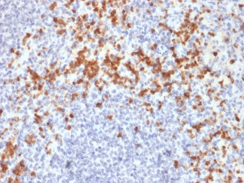 Immunohistochemistry analysis of MMP9 / Matrix metalloproteinase-9 antibody (clone SPM425) in human spleen tissue FFPE human spleen section shows cytoplasmic brown chromogenic staining in scattered immune cells consistent with MMP9 expression, while surrounding lymphoid cells display minimal staining and nuclei appear blue. Heat-induced epitope retrieval was performed by boiling tissue sections in pH 9 10 mM Tris with 1 mM EDTA for 20 minutes followed by cooling prior to staining.