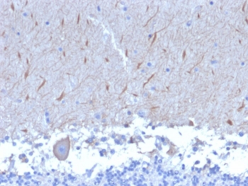 IHC staining of FFPE human brain with ATG5 antibody (clone ATG5/2553). HIER: boil tissue sections in pH 9 10mM Tris with 1mM EDTA for 10-20 min and allow to cool before testing.