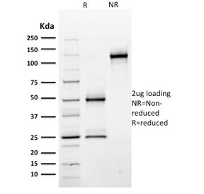 SDS-PAGE analysis of purified, BSA-free CD44 antibody (clone BU75) as confirmation of integrity and purity.