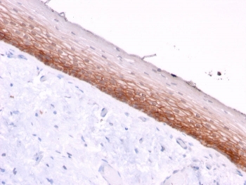 CD44v4/5 Antibody for IHC Cervix Tissue. Immunohistochemistry analysis of CD44 variant region / CD44 expression in FFPE human cervix tissue using mouse monoclonal antibody clone 3D2. Membranous HRP-DAB brown staining is observed along the epithelial layer, highlighting continuous cell borders and demonstrating organized stratified architecture consistent with CD44 variant-associated epithelial cohesion and tissue integrity. The staining pattern emphasizes basal layer prominence and supports its application in evaluating normal cervical epithelial morphology. Heat induced epitope retrieval was performed by boiling tissue sections in pH 9 10mM Tris with 1mM EDTA for 20 min followed by cooling at RT before testing.