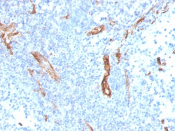 IHC staining of FFPE human prostate with CD31 antibody (clone PECAM1/3527). HIER: boil tissue sections in pH 9 10mM Tris with 1mM EDTA for 10-20 min and allow to cool before testing.