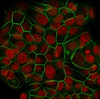 E-cadherin Antibody Clone SPM471 for IF. Immunofluorescence analysis of Cadherin 1 / CDH1 expression in human MCF7 cells using clone SPM471 antibody (green), showing strong membrane staining outlining epithelial cell borders, with Reddot nuclear stain (red). Signal highlights continuous cell-cell junctions and well-defined epithelial adhesion patterns.