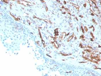 IHC staining of FFPE human tonsil with CD31 antibody (clone PECAM1/3529). HIER: boil tissue sections in pH 9 10mM Tris with 1mM EDTA for 10-20 min and allow to cool before testing.