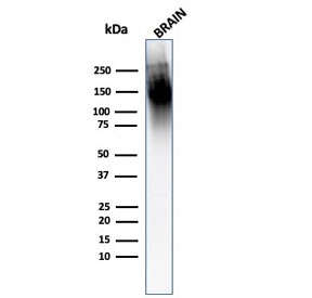 Western blot testing of human brain with Neurofilament antibody (clone 2F11).