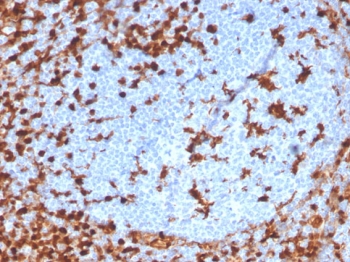 IHC staining of FFPE human tonsil with recombinant Annexin A1 antibody (clone ANXA1/3869R). HIER: boil tissue sections in pH 9 10mM Tris with 1mM EDTA for 10-20 min and allow to cool before testing.