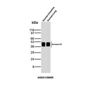 Recombinant Annexin A1 Antibody in Human Intestine and Lung WB. Western blot testing of Recombinant Annexin A1 Antibody clone ANXA1/3869R in human intestine and lung tissue lysates. A strong Annexin A1 band is observed at approximately 36-38 kDa in both tissues, demonstrating detection of endogenous ANXA1 in the tested human samples.