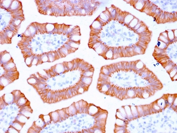 CK20 Antibody / Cytokeratin 20 (clone KRT20/3129R). Immunohistochemistry analysis of FFPE human colon tissue using recombinant rabbit monoclonal CK20 antibody (clone KRT20/3129R). HRP-DAB brown chromogenic staining highlights cytoplasmic Keratin 20 / Cytokeratin 20 (KRT20) expression in epithelial cells lining colonic glandular crypt structures, while surrounding stromal cells remain largely negative. The staining pattern reflects the expected epithelial localization of this intermediate filament protein in gastrointestinal mucosa. HIER: boil tissue sections in pH 9 10 mM Tris with 1 mM EDTA for 20 min and allow to cool before testing.