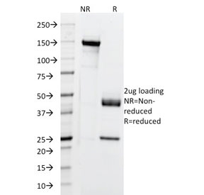 SDS-PAGE analysis of purified, BSA-free Cytokeratin 5/6/18 antibody (clone SPM267) as confirmation of integrity and purity.