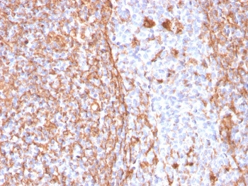 Vimentin Antibody / Cell Adhesion Marker Antibody for IHC. Immunohistochemistry analysis of FFPE human tonsil tissue using Vimentin antibody. The rabbit monoclonal clone VIM/1937R shows strong HRP-DAB brown cytoplasmic staining in stromal cells and supporting tissue architecture, with minimal staining in lymphoid cell populations. The staining pattern highlights interconnected stromal networks and cell-matrix interfaces, consistent with cytoskeletal anchoring and adhesion-associated structures. This distribution reinforces the use of Vimentin as a cell adhesion marker for identifying mesenchymal stromal compartments and structural support elements within lymphoid tissue.
