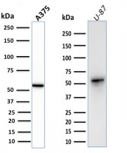 Vimentin Antibody / Cell Adhesion Marker Antibody WB. Western blot analysis of human A375 and U-87 cell lysates using Vimentin antibody. The rabbit monoclonal clone VIM/1937R detects a prominent band at approximately 55 kDa, consistent with the predicted molecular weight of Vimentin (VIM). The presence of a clear, single band across both cell lines supports detection of cytoskeletal components associated with adhesion-linked structural integrity. This banding pattern aligns with the role of Vimentin in anchoring intermediate filaments to adhesion complexes and reinforces its use as a cell adhesion marker in mesenchymal and tumor-derived cells.