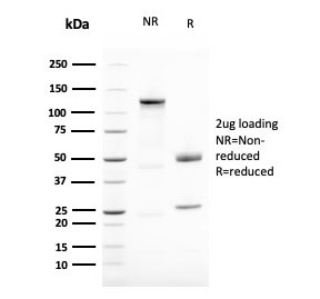SDS-PAGE analysis of purified, BSA-free Vimentin antibody (clone VIM/1937R) as confirmation of integrity and purity.