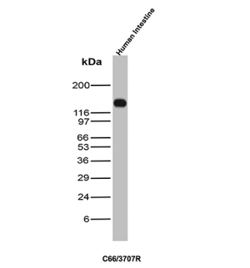 CEA Antibody Intestine WB. Western blot analysis of CEA / CEACAM5 expression in human intestine tissue lysate using recombinant CEA antibody, clone C66/3707R. Lane 1: human intestine tissue lysate. A strong band is detected at approximately 180-200 kDa, consistent with the predicted molecular weight of CEACAM5, with the elevated apparent size reflecting extensive glycosylation characteristic of this epithelial cell surface glycoprotein.