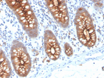 CEA Antibody Human Colon Tissue IHC. Immunohistochemistry analysis of CEA / CEACAM5 expression in FFPE human colon tissue using recombinant CEA antibody, clone C66/3707R. This CEA antibody demonstrates strong apical membranous HRP-DAB brown staining in glandular epithelial cells, with luminal accentuation and minimal signal in surrounding stromal cells; nuclei are counterstained blue. The staining pattern reflects polarized localization of carcinoembryonic antigen within intestinal epithelium. Antigen retrieval was performed by boiling sections in 10 mM Tris buffer with 1 mM EDTA, pH 9, for 20 min followed by cooling at room temperature.