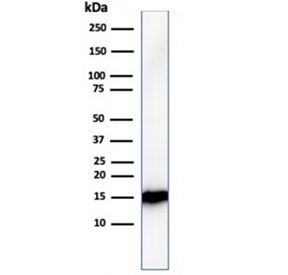 FABP1 Antibody - Microarray Validated WB. Western blot testing of human kidney lysate with FABP1 antibody (clone FABP1/3482). Predicted molecular weight: ~14 kDa.