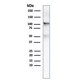 Western blot testing of human LNCaP lysate with FOLH1 antibody. Predicted molecular weight ~100 kDa.