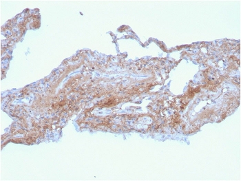 FN1 Antibody Human Lung IHC. Immunohistochemistry analysis of FFPE human lung tissue stained with clone FN1/2948. Extracellular and stromal HRP-DAB brown staining is observed throughout connective tissue and alveolar-associated matrix regions, consistent with expression of Fibronectin 1 / FN1 within extracellular matrix remodeling and tissue organization pathways. Clone FN1/2948 is supported by HuProt(TM) protein microarray specificity validation demonstrating highly selective recognition of FN1 in complex protein environments. HIER: boil tissue sections in pH 9 10mM Tris with 1mM EDTA for 20 min and allow to cool before testing.