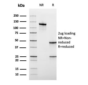 SDS-PAGE analysis of purified, BSA-free recombinant CD45RA antibody (clone rPTPRC/1131) as confirmation of integrity and purity.