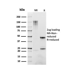 SDS-PAGE analysis of purified, BSA-free CD163 antibody (clone M130/2163) as confirmation of integrity and purity.