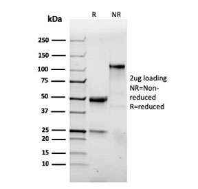 SDS-PAGE analysis of purified, BSA-free recombinant Integrin alpha E antibody (clone ITGAE/3904R) as confirmation of integrity and purity.