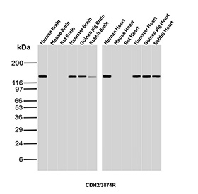 CDH2 Antibody Brain and Heart Tissue WB. Western blot analysis of N-Cadherin / CDH2 expression across multi-species brain and heart tissue lysates using CDH2 antibody clone CDH2/3874R. Lane 1: human brain lysate, Lane 2: mouse brain lysate, Lane 3: rat brain lysate, Lane 4: hamster brain lysate, Lane 5: guinea pig brain lysate, Lane 6: rabbit brain lysate, Lane 7: human heart lysate, Lane 8: mouse heart lysate, Lane 9: rat heart lysate, Lane 10: hamster heart lysate, Lane 11: guinea pig heart lysate, Lane 12: rabbit heart lysate. A band is detected at approximately 120-135 kDa, consistent with the predicted molecular weight of N-Cadherin (CDH2), with the higher apparent migration reflecting known glycosylation of this transmembrane adhesion protein. Consistent detection across species and tissues supports the use of this CDH2 Antibody / N-Cadherin Cross-Species Reactivity Antibody for comparative studies, reflecting the conserved expression of N-Cadherin in both neural and cardiac systems.