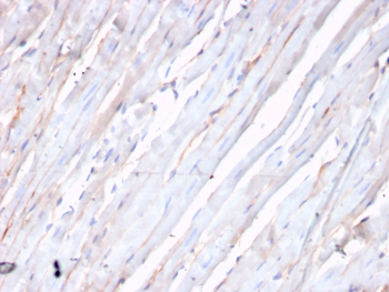 CDH2 Antibody Heart Tissue IHC. Immunohistochemical analysis of N-Cadherin / CDH2 expression in formalin-fixed, paraffin-embedded human heart tissue using CDH2 antibody. Membranous and cytoplasmic staining is observed in cardiomyocytes, with signal accentuated along cell-cell junctions consistent with localization at intercalated discs. The staining highlights elongated cardiac muscle fibers with expected structural organization, while surrounding stromal areas show minimal background. HIER: boil tissue sections in pH 9 10mM Tris with 1mM EDTA for 20 min and allow to cool before testing.