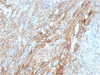 IHC staining of FFPE human lung with Fibronectin antibody (clone FN1/3029). HIER: boil tissue sections in pH 9 10mM Tris with 1mM EDTA for 20 min and allow to cool before testing.