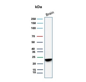 Western blot testing of human brain tissue with recombinant Myelin Basic Protein antibody. Expected molecular weight: 22-37 kDa.