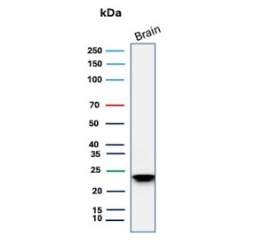Western blot testing of human brain lysate with recombinant MBP antibody (clone rMBP/4288). Isoforms may be visualized from 20~37 kDa.