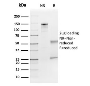 SDS-PAGE analysis of purified, BSA-free FGF21 antibody (clone FGF21/3691) as confirmation of integrity and purity.