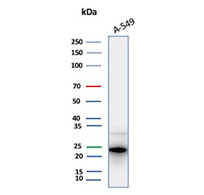 FTL Antibody A549 WB. Western blot analysis of A549 cell lysate using FTL Antibody detects a strong band at approximately 20-24 kDa, consistent with ferritin light chain / FTL. The observed signal supports expression of this intracellular iron storage protein in lung-derived epithelial tumor cells and is consistent with the role of FTL in ferritin complex assembly, cellular iron sequestration, and oxidative stress-associated metabolic regulation pathways.