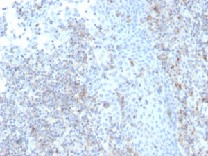 CD50 Antibody rICAM3/1019 in Human Tonsil IHC. Immunohistochemistry staining of FFPE human tonsil tissue with CD50 Antibody, clone rICAM3/1019. Tissue sections underwent HIER by boiling in 10 mM Tris with 1 mM EDTA, pH 9, for 20 min followed by cooling before testing. The image shows positive staining among lymphoid cells, with heterogeneous staining intensity across the tissue. This pattern is consistent with detection of the leukocyte-associated LFA-1 Ligand CD50 in human tonsil.