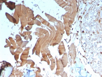 Creatine Kinase M Antibody Human Skeletal Muscle Tissue IHC. Immunohistochemistry staining of FFPE human skeletal muscle tissue with Creatine Kinase M antibody (clone CKMM/3341). HIER: boil tissue sections in pH 9 10mM Tris with 1mM EDTA for 20 min and allow to cool before testing.