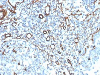 Immunohistochemistry of Collagen IV antibody in human tonsil. Formalin-fixed, paraffin-embedded human tonsil tissue was stained using a rabbit monoclonal COL4/4241R, Collagen IV antibody. Heat induced epitope retrieval was performed by boiling tissue sections in 10mM Tris with 1mM EDTA, pH 9, for 20 min followed by cooling prior to staining. HRP-DAB brown chromogenic signal highlights vascular basement membranes and stromal extracellular matrix structures, outlining small blood vessels and reticular frameworks consistent with Collagen type IV localization.