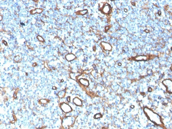 IHC staining of FFPE human tonsil with Collagen IV antibody rabbit monoclonal clone COL4/4241R. HIER: boil tissue sections in pH 9 10mM Tris with 1mM EDTA for 20 min and allow to cool before testing.
