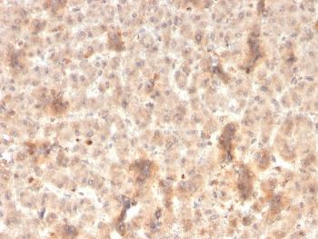 Secretory Component Antibody Liver IHC. Immunohistochemistry staining of FFPE human liver with recombinant Secretory Component antibody (clone rSPM217). HIER: boil tissue sections in pH 9 10mM Tris with 1mM EDTA for 20 min and allow to cool before testing.