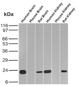 FTH Antibody Brain and Kidney WB. Western blot analysis of human, mouse, and rat brain and kidney tissue lysates using monoclonal clone FTH/2082 demonstrates distinct bands near 20-24 kDa corresponding to Ferritin heavy chain / FTH1 across multiple species and tissue types. The conserved expression profile supports the established role of FTH proteins in intracellular iron sequestration, oxidative stress protection, and maintenance of cellular iron homeostasis within metabolically active neural and renal tissues.